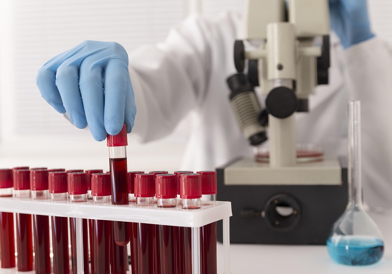 The Science Behind Blood Storage Temperature: Why 4 °C Is the Gold Standard